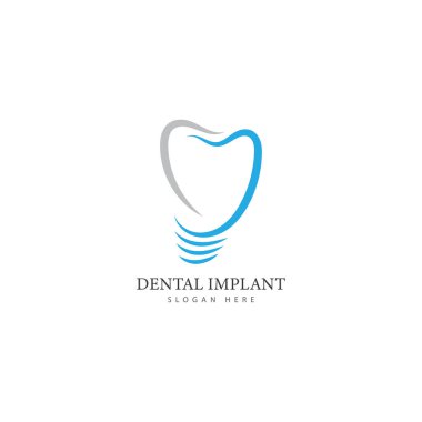 Diş implantı logo tasarımı konsept vektör diş bakımı logo şablonu