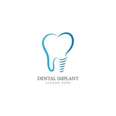 Diş implantı logo tasarımı konsept vektör diş bakımı logo şablonu