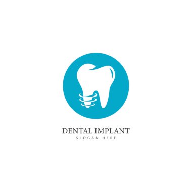 Diş implantı logo tasarımı konsept vektör diş bakımı logo şablonu