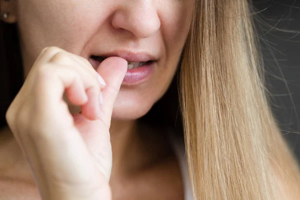 Young woman biting her fingernails. Closeup, selective focus. Nervous breakdown