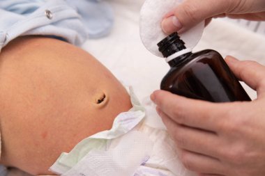 Anne elleri yeni doğmuş bir bebeğin karnını tedavi etmek için ilaç tutuyor. Yakın çekim.