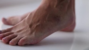 Kadın büyük şişmiş damarlarla ayağına dokunuyor. Varis damar konsepti. 4K görüntü.