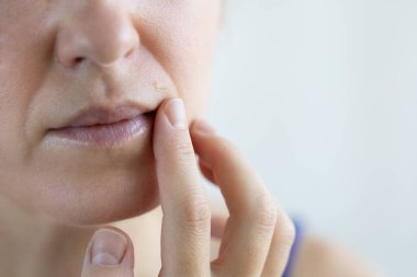 Yüzünde aşırı kıllar olan bir kadın. Kadın yüzünde kıl olan bir ben. Yakın çekim.