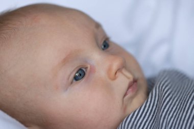 Yüzünde kırmızı sivilceler ve gözlerinin altında kırmızı noktalar olan yeni doğmuş bir bebek.. 