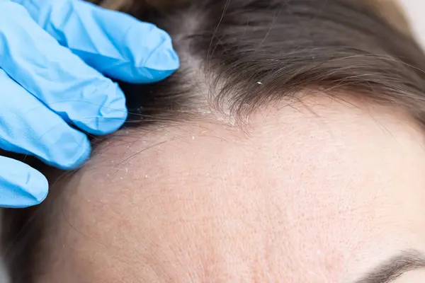 Bir dermatologla randevum var. Kadının kafasında deri iltihabı var.