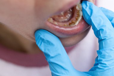 Diş temizliği için dişçiyle randevu.. 