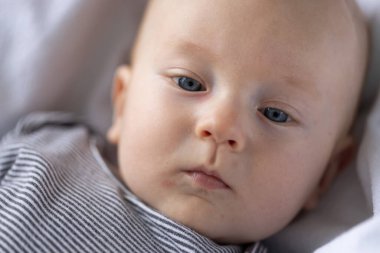 Yüzünde kırmızı sivilceler ve pembe gözlü yeni doğmuş bir bebek. Yakın çekim.