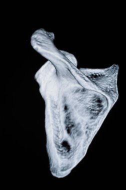 İnsan kemiği tomografisi