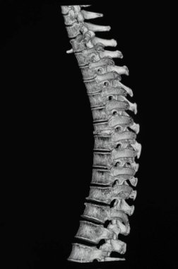 Siyah arkaplanda omurga MRI görüntüsü