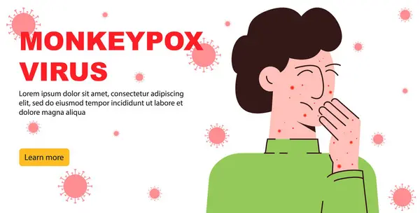 Mpox virüsü konsept pankartı tehlikesi. Maymun düz çiziminden bulaşmış çocuk. Maymun çiçeği insan derisine çok yakın. Çizgi film sahne cildi sorunu beyaz arkaplanda izole edildi.