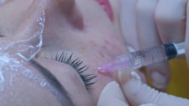 Güzellik ve enjeksiyon konsepti. Klinikte kozmetoloji. Beyaz eldiven giyen deneyimli bir güzellik uzmanı bir kadının yüzüne gerekli aktif malzemeleri enjekte eder.