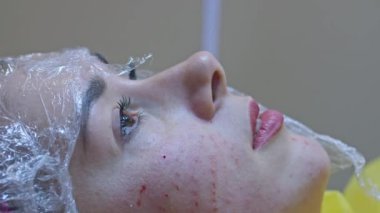 Güzellik ve enjeksiyon konsepti. Klinikte kozmetoloji. Beyaz eldiven giyen deneyimli bir güzellik uzmanı bir kadının yüzüne gerekli aktif malzemeleri enjekte eder.