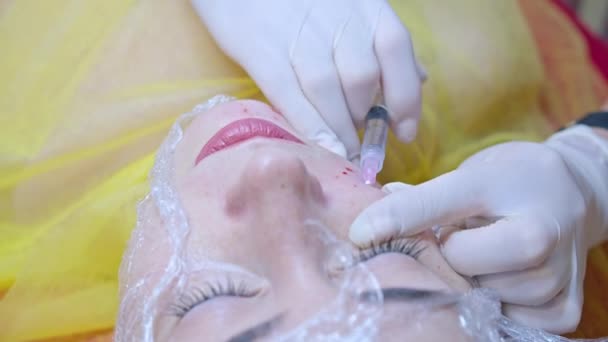 美容和注射的概念 美容学在诊所 一位戴着白色手套的经验丰富的美容师向女性面部注射含有必要活性成分的皮下注射 — 图库视频影像