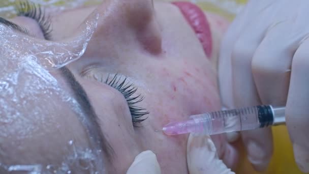 Krása Vstřikování Kosmetika Klinice Zkušený Kosmetik Bílých Rukavicích Aplikuje Subkutánní — Stock video