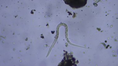 Pek çok mikro organizmanın bir örneğinden karakteristik spazmlarda hareket eden tek bir nematodun mikroskopi görüntüleri..