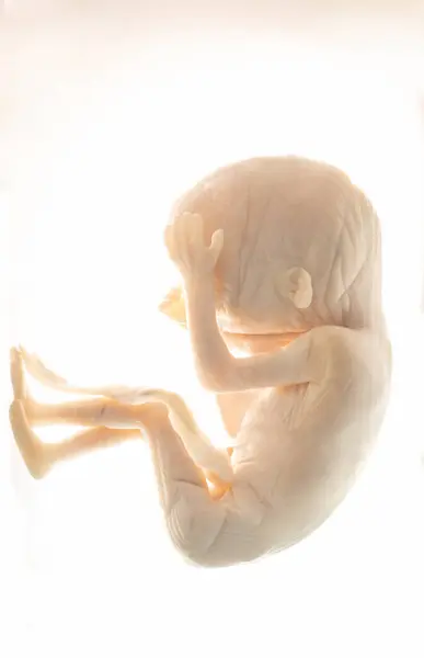 Ungeborener Fötus Formalin Lösung Medizinische Forschung Stockbild