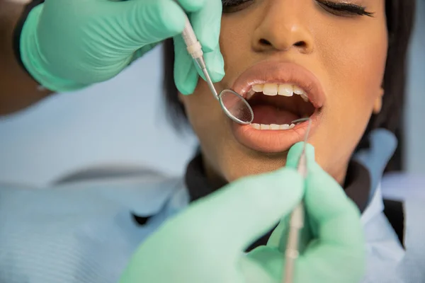 close-up of an african patient's mouth during a dental visit, dental care concept.