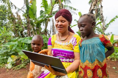 Mutlu Afrikalı albino anne çocuklarına tablet dersi veriyor. Eğitim kavramı.