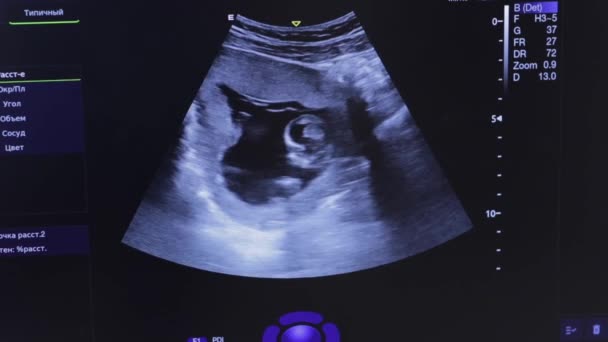 Baby Mother Womb Ultrasonography Pregnant Woman — Vídeo de Stock