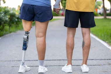 Couple with prosthetic leg from amputation walking exercise in public park together for disability and handicap people and diversity with universal design for better accessibility infrastructure clipart