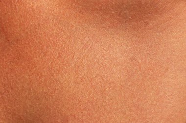 Brown human skin texture. Sunburned woman skin closeup clipart