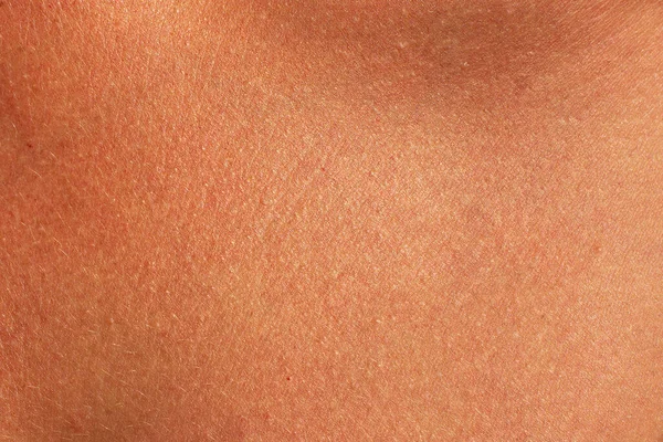 Brown Human Skin Texture Sunburned Woman Skin Closeup — Stock Photo, Image