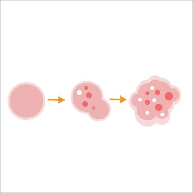 Kanser Hücre Büyümesi ve Bölüm Kanser Hastalığı Konsepti