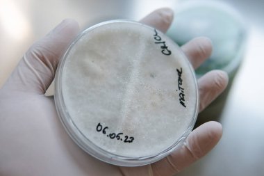 Mycelium seçimi, mantar yetiştirme ve laboratuvar koşullarında rezervasyon. Modern dünyada tıbbi işlevsel mantarlar
