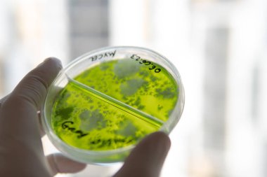 Mycelium seçimi, mantar yetiştirme ve laboratuvar koşullarında rezervasyon. Modern dünyada tıbbi işlevsel mantarlar