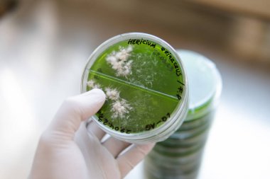 Popüler tıbbî mantarlar, aslanların insanlar üzerindeki etkisi. Mantarların geleceği ve onların insanlığı kurtarmadaki rolü. Mantar kültürünün miselyumlu petri kabı.