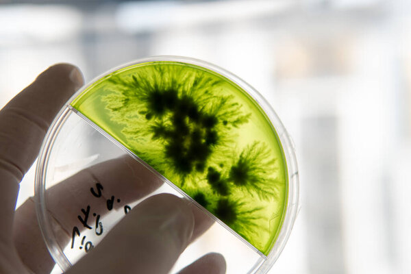 Mycelium selection, cultivation and reservation of mushrooms under laboratory conditions. Medical functional fungi in the modern world