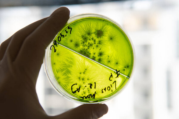 Popular medicinal mushrooms, the beneficial effects of the lions mane mushroom on humans. The future of mushrooms and their role in saving humanity. Petri dish with mycelium of mushroom culture