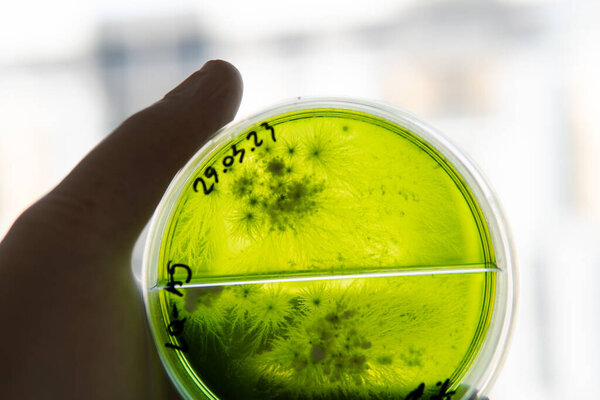 Popular medicinal mushrooms, the beneficial effects of the lions mane mushroom on humans. The future of mushrooms and their role in saving humanity. Petri dish with mycelium of mushroom culture