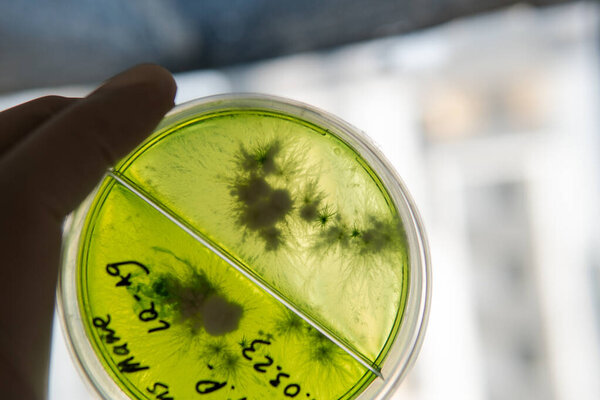 Mycology and conservation of mushroom cultures. Mycelium of the lions mane mushroom, mycelium in a Petri dish. Breeding of mushroom cultures