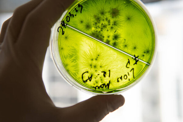 Mycology and conservation of mushroom cultures. Mycelium of the lions mane mushroom, mycelium in a Petri dish. Breeding of mushroom cultures
