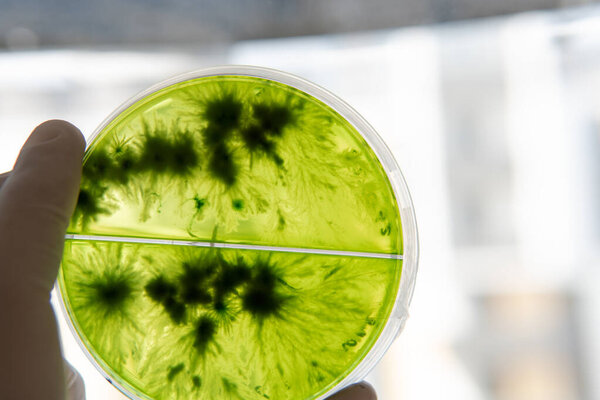 Mycology and conservation of mushroom cultures. Mycelium of the lions mane mushroom, mycelium in a Petri dish. Breeding of mushroom cultures