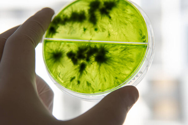 Mycology and conservation of mushroom cultures. Mycelium of the lions mane mushroom, mycelium in a Petri dish. Breeding of mushroom cultures