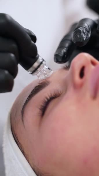 Kosmetikerin Führt Hydrodermabrasion Durch Die Poren Reinigen Die Verjüngung Fördern — Stockvideo