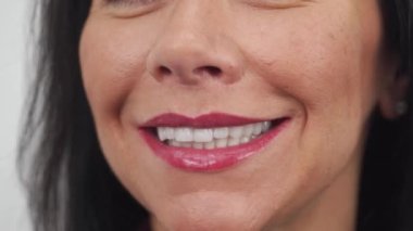 Zirkon kaplamaları ve diş seramik kaplamaları taktıktan sonra kadınların gülümsemesi. Dişlerin porselen kaplamalarla estetik diş tedavisinden sonra gülümseyen kadın hasta. Mükemmel Hollywood gülüşü.