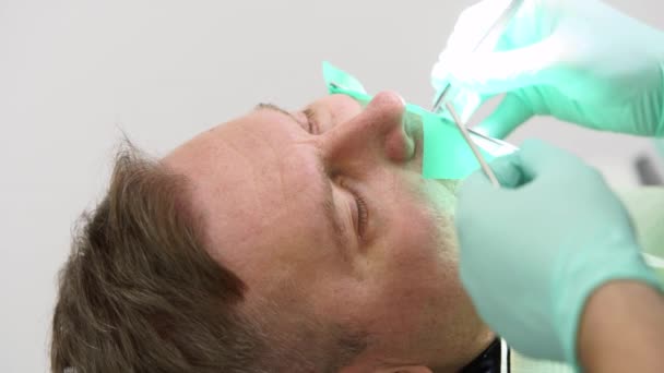 病人面对棺材时的特写镜头 牙医的手用橡胶坝治疗牙齿病人 病人在一个现代化的牙科诊所接受治疗 集中的口腔外科医生切除神经 — 图库视频影像