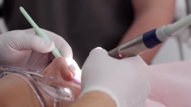 在现代牙科诊所 牙医手拿着手套近距离治疗病人的牙齿 胃科医生摘除安装牙龈的牙釉质 医生治疗根管 牙科手术 — 图库视频影像