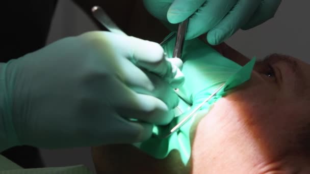 病人面对棺材时的特写镜头 牙医的手用橡胶坝治疗牙齿病人 病人在现代牙科诊所接受牙科治疗 胃科医生治疗龋病 — 图库视频影像