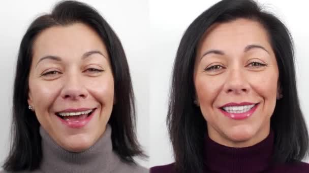 Woman Zirconia Veneers Dental Ceramic Crown Female Patient Talk Camera — Stock Video