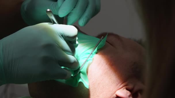 コファダムと直面する患者のクローズアップショット 歯科医の手は ゴムダムを使用して歯の患者を治療しています 患者は現代歯科オフィスで歯科治療を受けています ドクターは猫を腐敗させる — ストック動画
