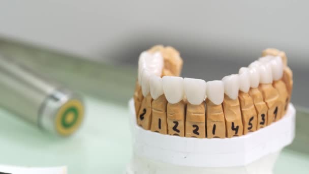 ジルコニアのベニヤと王冠のクローズアップは 現代の歯科実験室で患者のための準備ができています 歯科用に最適なセラミック歯科インプラント 歯科医はベニヤを取る手をとります コスメティック歯科 — ストック動画