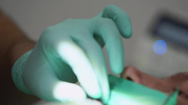 Elektroniczny Lokalizator Wierzchołków Pracujący Podczas Pracy Dentyści Trzymają Ręce Rękawiczkach — Wideo stockowe