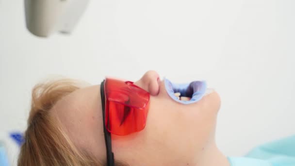 若い女性は現代の歯科医院で白くする紫外線歯の保護赤い眼鏡に直面しています 歯科医は女性患者の歯を漂白し始めます 医学的処置で口を開いた少女 クローズアップ — ストック動画