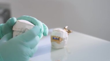 Diş teknisyenlerinin elleri, diş laboratuarındaki takma dişlerin kalitesini kontrol ediyor. Kadın dişçi modern stomatoloji ofisinde takma diş yaparken çenenin alçı kalıbını tutuyor. Protez dişçilik. Yakın plan..