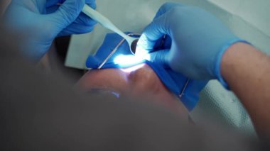 Diş hekimlerinin kök kanallarını tedavi ederken yakın plan fotoğrafları, modern diş kliniğinde cofferdam hastası. Doktor elleri kadınların dişlerini ayna kullanarak tedavi eder. Taşıyıcıların kaldırılması, dolum kurulumu.
