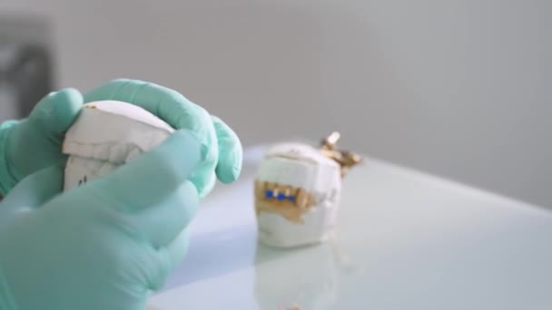 歯科実験室で歯の質をチェックする歯科技術者 女性歯科医は 現代の歯科オフィスで入れ歯を作っている間 顎のプラスターキャストを保持しています 歯医者さん クローズアップ — ストック動画